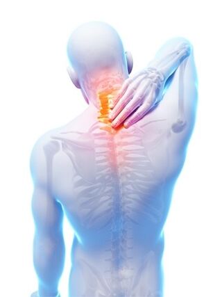 Hondrocream'in vazgeçilmez olduğu spinal osteokondroz