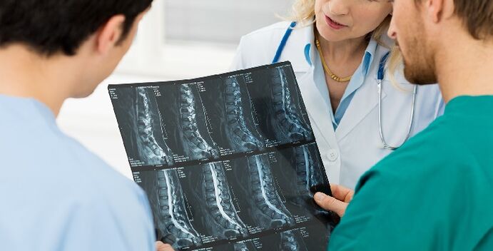 Osteokondrozu teşhis etmenin bir yolu olarak omurganın röntgeni